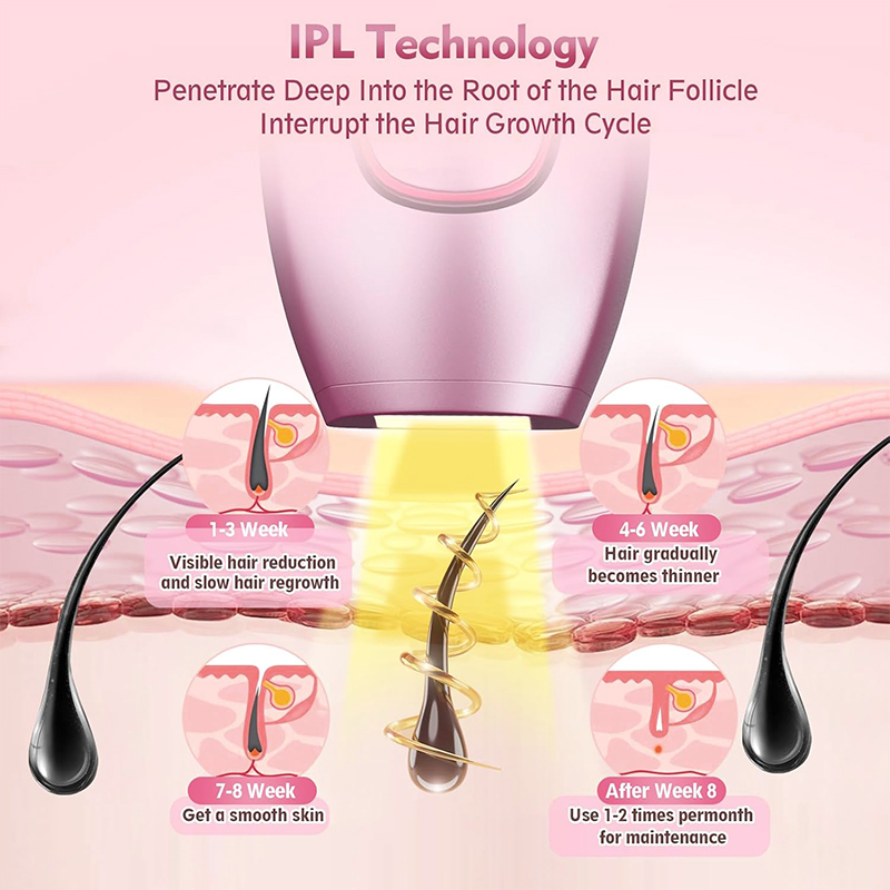 IPL Laser Penghilang Rambut Me - Industrial Laser Cutter ulasan dan harga